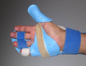 Private UE Splinting/Orthosis Courses